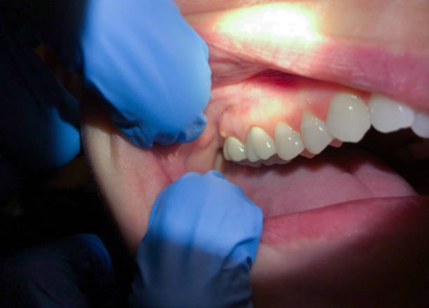 Best Emergency Treatment for Jaw Pain or Injury in Crystal Lakes, OH